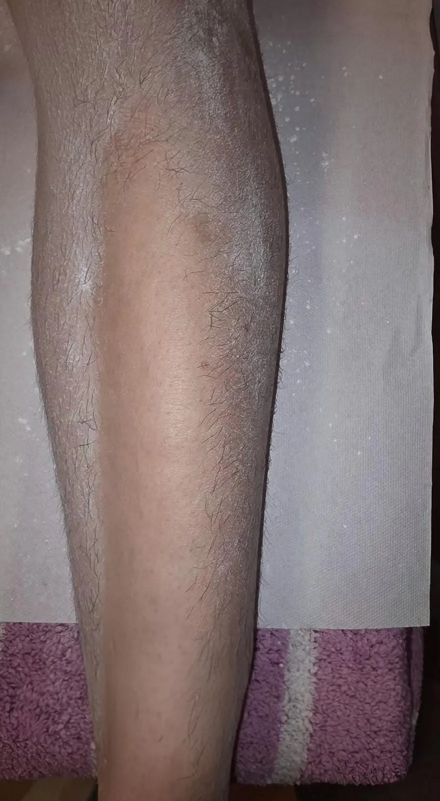 Noga tokom depilacije šećernom pastom